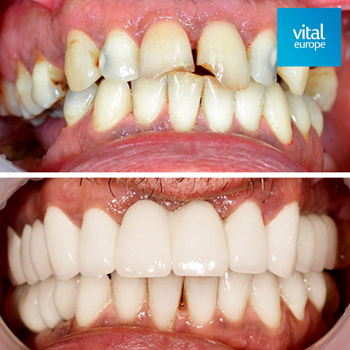 before - after result 12