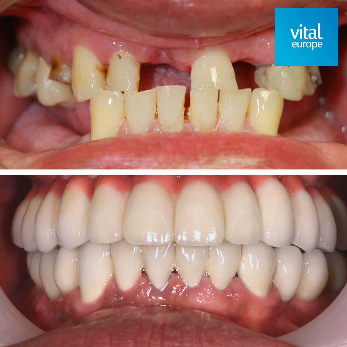 before - after result 8