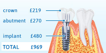 implant01