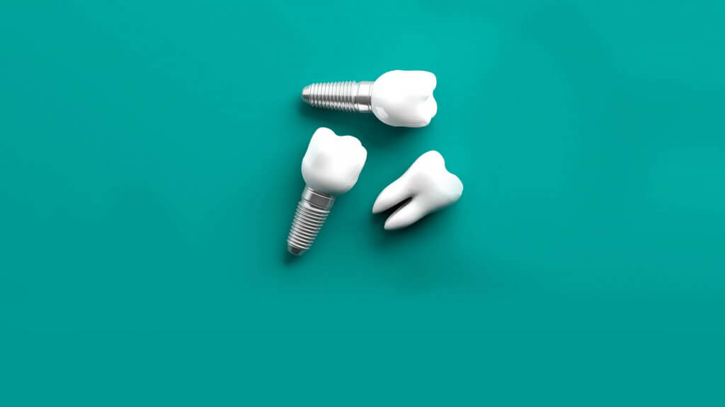 implants