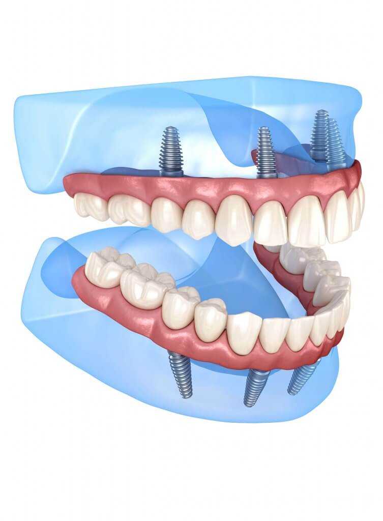 modern dentistry model