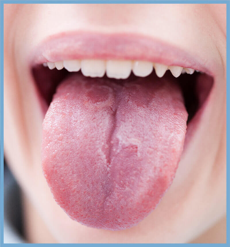 tongue