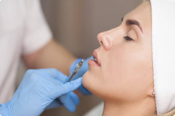 Lip Fillers