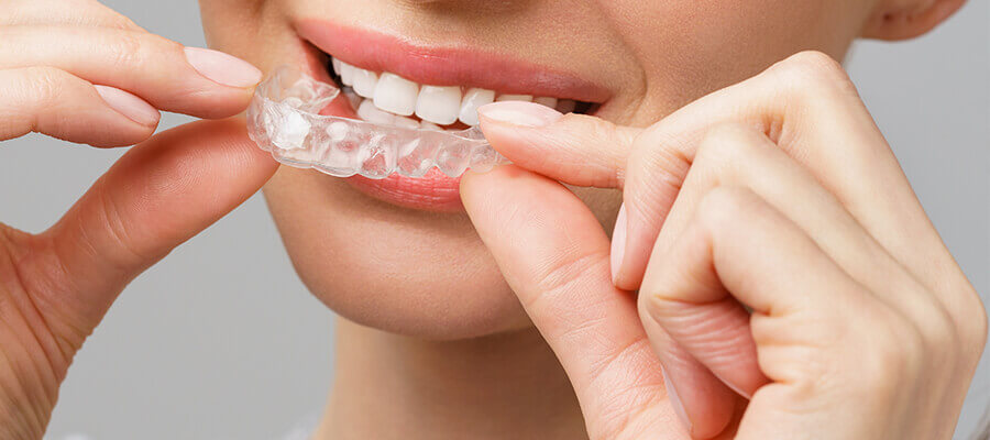 tooth whitening