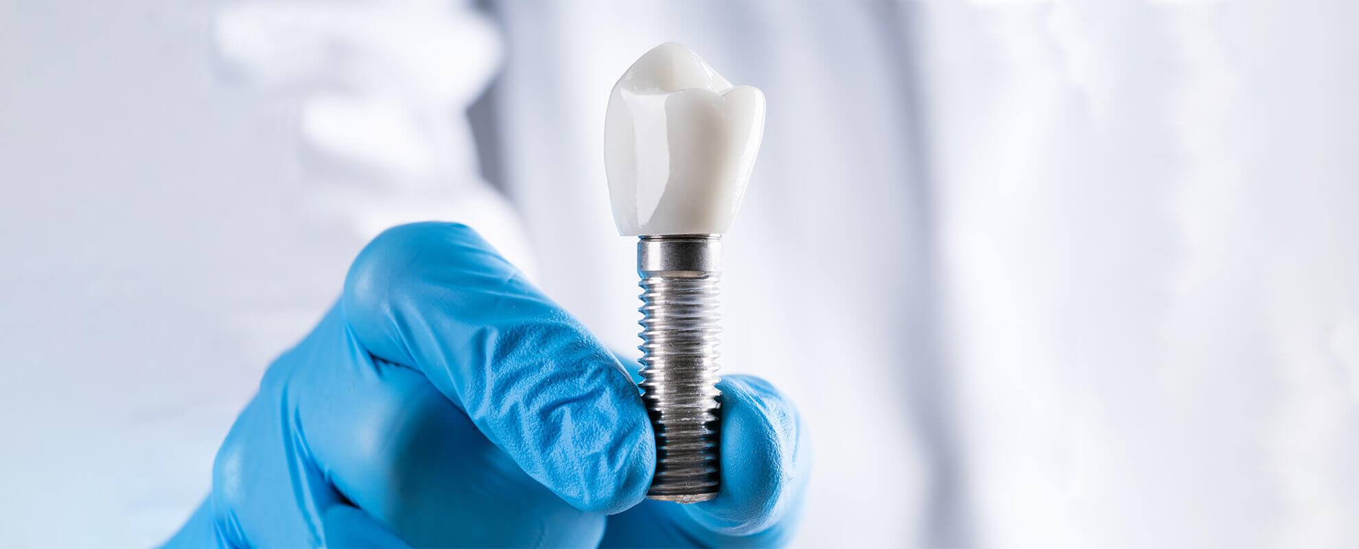 dental implant