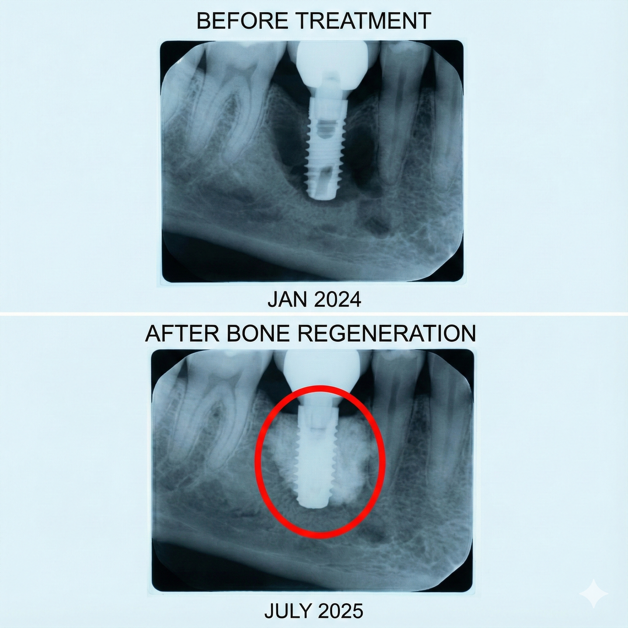 CBCT Before After X ray